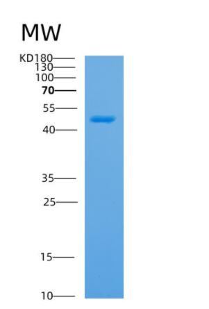 Recombinant Human APOBEC4 Protein,Recombinant Human APOBEC4 Protein