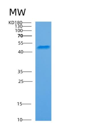 Recombinant Human ARC Protein,Recombinant Human ARC Protein