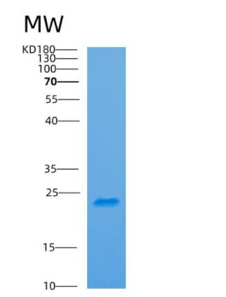 Recombinant Human ARF6 Protein,Recombinant Human ARF6 Protein