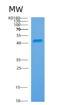 Recombinant Human ARFIP1 Protein,Recombinant Human ARFIP1 Protein