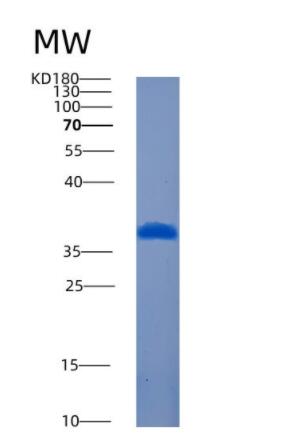 Recombinant Human AMMECR1L Protein,Recombinant Human AMMECR1L Protein