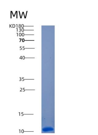 Recombinant Human ANAPC13 Protein,Recombinant Human ANAPC13 Protein