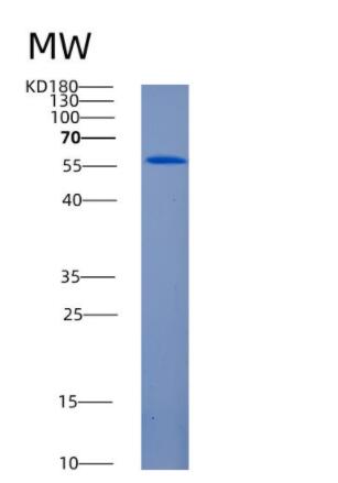 Recombinant Human ANGPT1 Protein,Recombinant Human ANGPT1 Protein