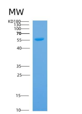 Recombinant Human ANXA11 Protein,Recombinant Human ANXA11 Protein