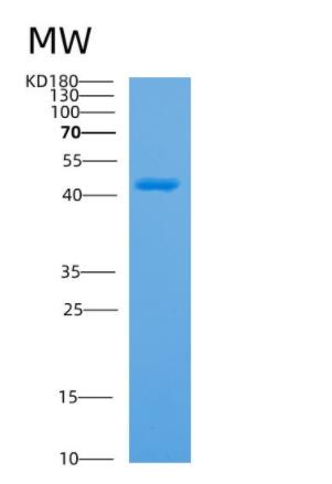 Recombinant Human APMAP Protein,Recombinant Human APMAP Protein