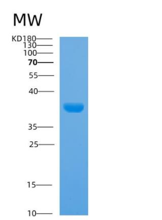 Recombinant Human ARG2 Protein,Recombinant Human ARG2 Protein