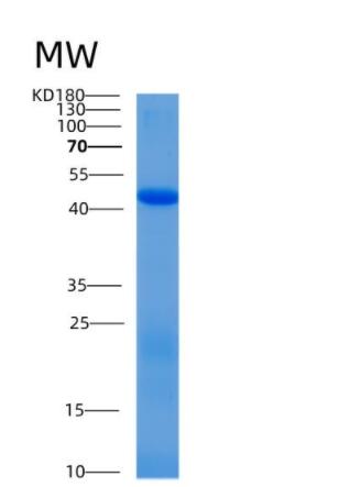 Recombinant Human Alix Protein,Recombinant Human Alix Protein