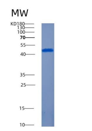 Recombinant Human AMT Protein,Recombinant Human AMT Protein