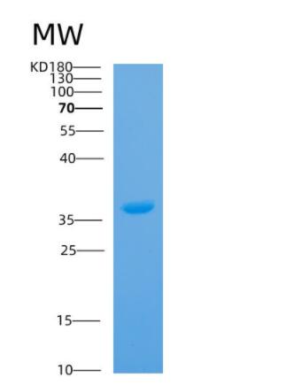 Recombinant Human ANXA13 Protein,Recombinant Human ANXA13 Protein