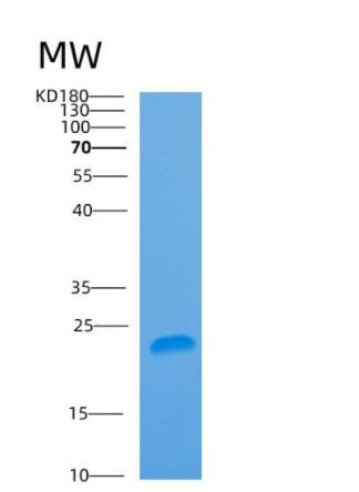 Recombinant Human ARL5B Protein,Recombinant Human ARL5B Protein