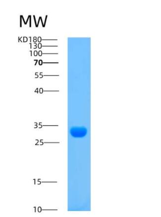 Recombinant Human ARPC3 Protein,Recombinant Human ARPC3 Protein