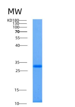 Recombinant Human ALKBH2 Protein,Recombinant Human ALKBH2 Protein