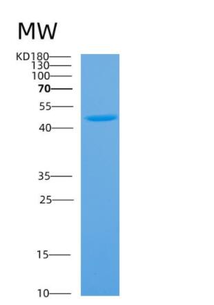 Recombinant Human α1-antichymotrypsin Protein,Recombinant Human α1-antichymotrypsin Protein