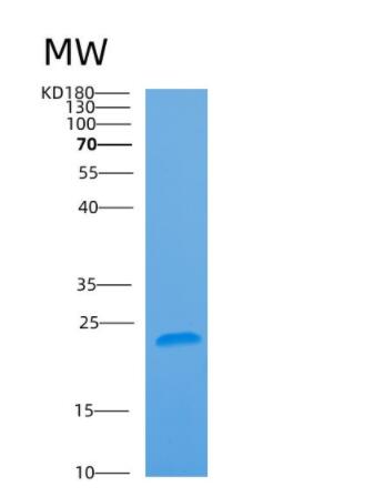 Recombinant Human ARL5A Protein,Recombinant Human ARL5A Protein