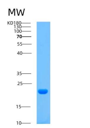 Recombinant Human ARPC5 Protein,Recombinant Human ARPC5 Protein