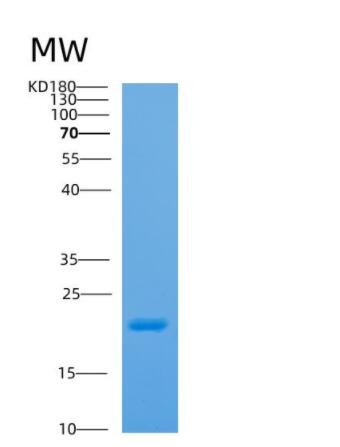 Recombinant Human AP1S2 Protein,Recombinant Human AP1S2 Protein