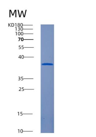 Recombinant Human AMN Protein,Recombinant Human AMN Protein