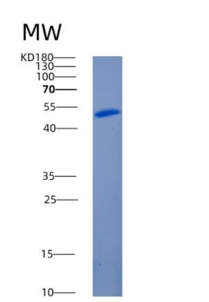 Recombinant Human ANGPTL3 Protein,Recombinant Human ANGPTL3 Protein