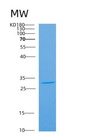 Recombinant Mouse Antxr2 Protein,Recombinant Mouse Antxr2 Protein