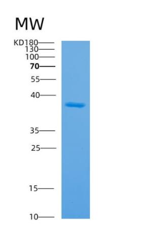 Recombinant Human APEX1 Protein,Recombinant Human APEX1 Protein