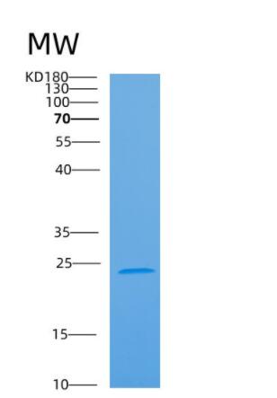 Recombinant Human ARL6 Protein,Recombinant Human ARL6 Protein