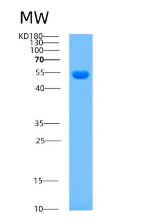 Recombinant Mouse Arsa Protein,Recombinant Mouse Arsa Protein