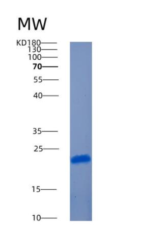 Recombinant Human AMTN Protein,Recombinant Human AMTN Protein