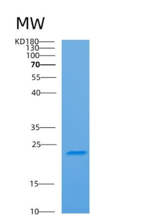 Recombinant Human ARF4 Protein,Recombinant Human ARF4 Protein