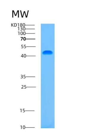 Recombinant Human ASCC1 Protein,Recombinant Human ASCC1 Protein