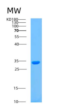 Recombinant Human ASB8 Protein,Recombinant Human ASB8 Protein