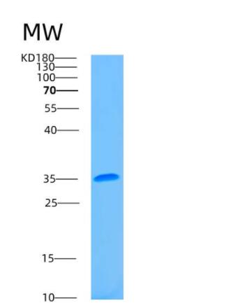 Recombinant Human ASMT Protein,Recombinant Human ASMT Protein