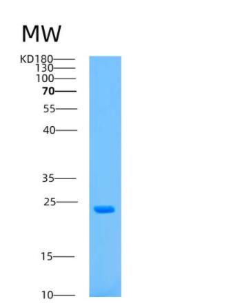 Recombinant Human ASPH Protein,Recombinant Human ASPH Protein