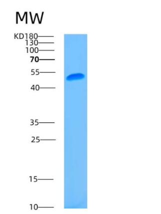 Recombinant Human ASL Protein,Recombinant Human ASL Protein