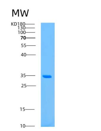 Recombinant Human ASRGL1 Protein,Recombinant Human ASRGL1 Protein