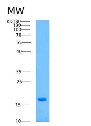 Recombinant Human ASPRV1 Protein,Recombinant Human ASPRV1 Protein