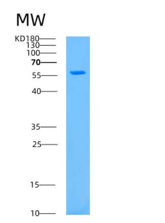 Recombinant Human Ataxin 3 Protein,Recombinant Human Ataxin 3 Protein