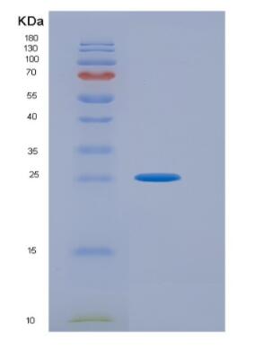 Recombinant Activating Transcription Factor 1 (ATF1),Recombinant Activating Transcription Factor 1 (ATF1)