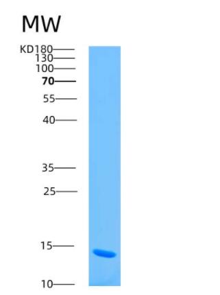 Recombinant Human ARSM2 Protein,Recombinant Human ARSM2 Protein