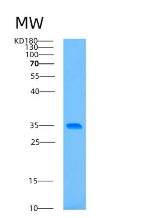 Recombinant Human ATG5 Protein,Recombinant Human ATG5 Protein