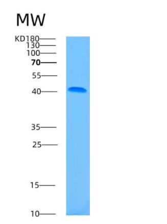 Recombinant Human ASNA1 Protein,Recombinant Human ASNA1 Protein