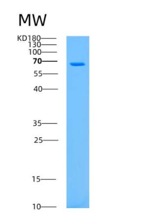 Recombinant Human ASPSCR1 Protein,Recombinant Human ASPSCR1 Protein