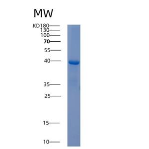 Recombinant Human AKR1C4 Protein