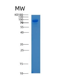 Recombinant Human ALCAM Protein