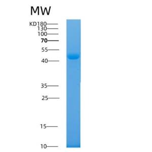 Recombinant Human AKR7A2 Protein