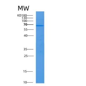 Recombinant Human ALB Protein,Recombinant Human ALB Protein