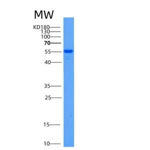 Recombinant Mouse Aldh2 Protein