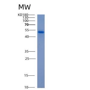 Recombinant Human ALDH5A1 Protein