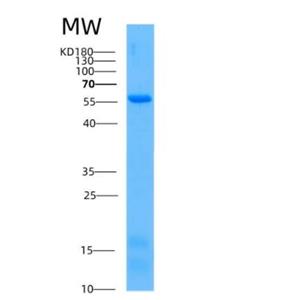 Recombinant Human AKT1 Protein