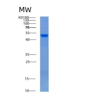 Recombinant Mouse Alpha-2-antiplasmin Protein,Recombinant Mouse Alpha-2-antiplasmin Protein