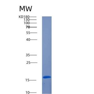 Recombinant Human ANG Protein,Recombinant Human ANG Protein